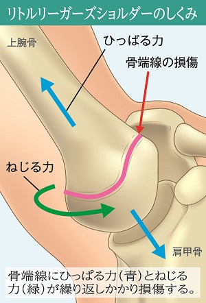 テンプレ