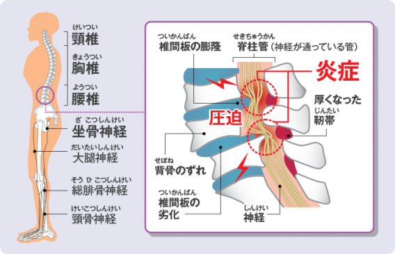 脊柱管ダスキンヘルスレント引用