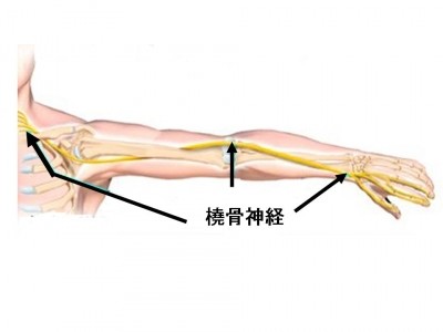 橈骨神経麻痺写真