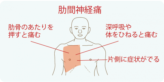 脇 の 痛み