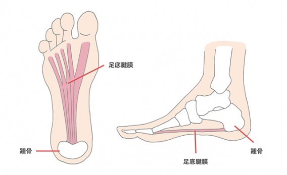 足底腱膜炎（足裏の痛み） | 【山形 寒河江市】整体・マッサージ師も通う「藤田接骨院」