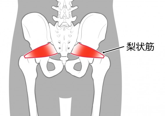 梨状筋症候群